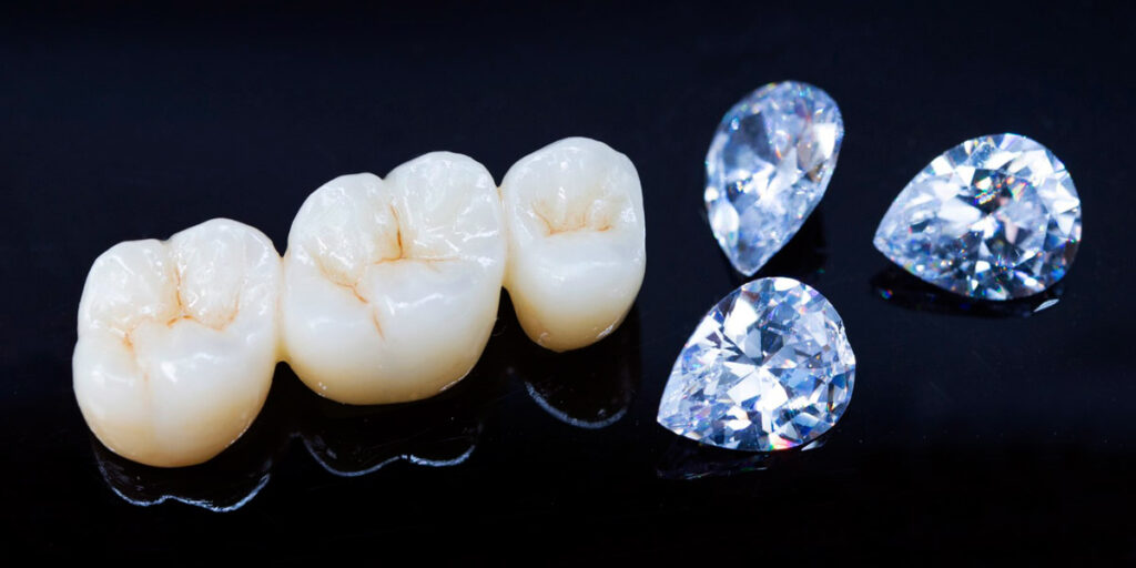 セラミック（ジルコニア）クラウンイメージ